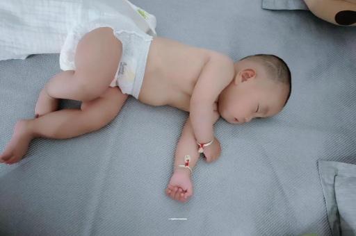 黄石宝宝头上长痱子